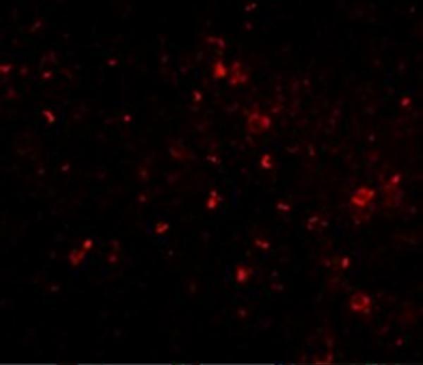 Immunofluorescence of ORAI1 in human spleen tissue with ORAI1 antibody at 20 μg/ml