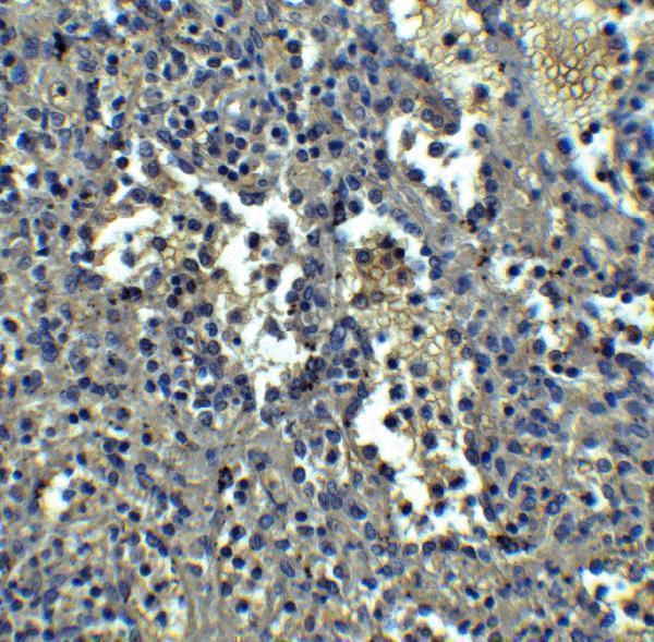Immunohistochemistry of ORAI1 in human spleen tissue with ORAI1 antibody at 5 μg/mL
