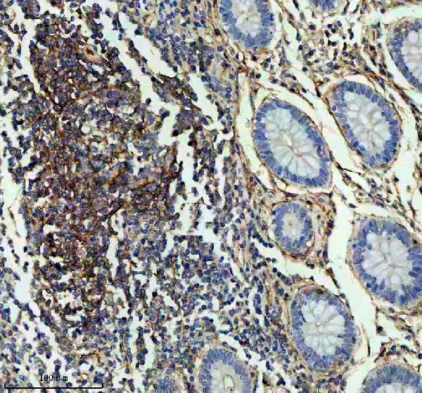 IHC analysis of CD55 using anti-CD55 antibody (M00910-2)