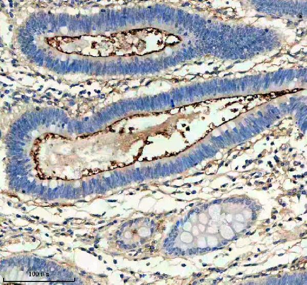 IHC analysis of CD55 using anti-CD55 antibody (M00910-2)