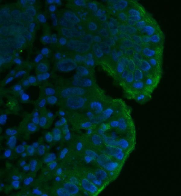 m00910 4 cd55 primary antibodies if testing 7