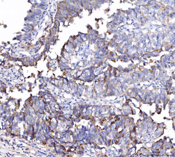  IHC analysis of CD55 using anti-CD55 antibody (M00910-4)