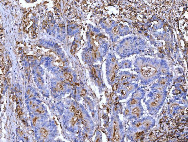  IHC analysis of CD55 using anti-CD55 antibody (M00910-4)