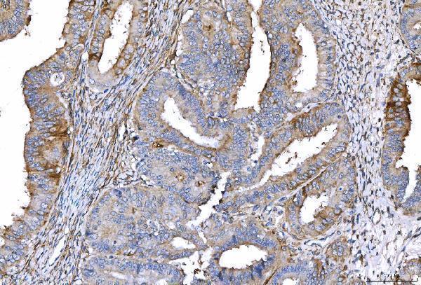 m00910 4 cd55 primary antibodies ihc testing 4