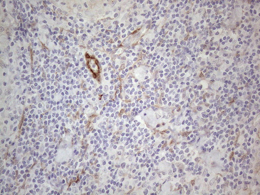 Immunohistochemical staining of paraffin-embedded Human lymph node tissue within the normal limits using anti-CSF2 mouse monoclonal antibody