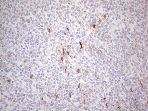 m00911 1 anti gm csf csf2 mouse monoclonal antibody clone id oti8g5 ihc testing 4