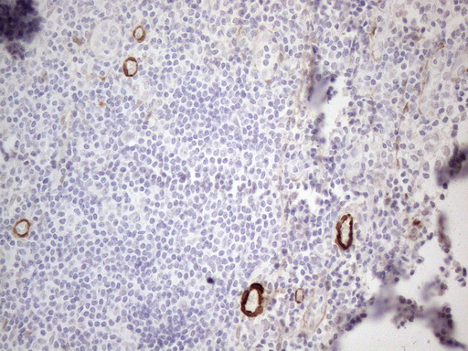 m00911 1 anti gm csf csf2 mouse monoclonal antibody clone id oti8g5 ihc testing 5