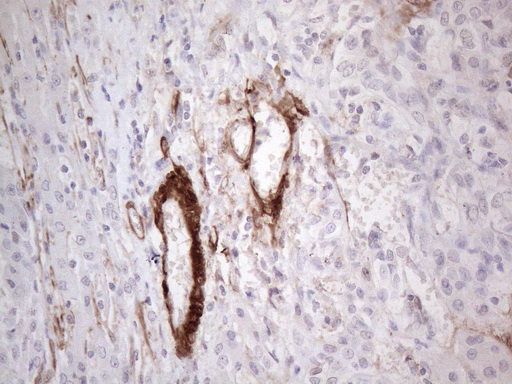m00911 1 anti gm csf csf2 mouse monoclonal antibody clone id oti8g5 ihc testing 6