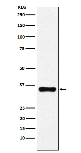 Western blot analysis of HOXA9 expression in 293T cell lysate