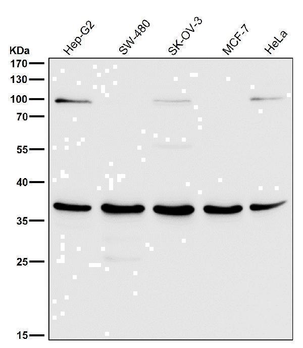 All lanes use the Antibody at 1:2K dilution for 1 hour at room temperature
