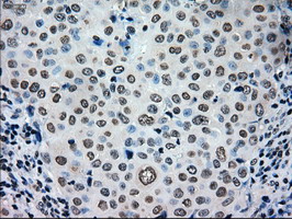 m00913 2 anti tyro3 mouse monoclonal antibody clone id oti5b4 ihc testing 10