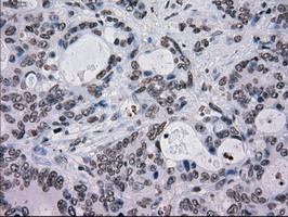 m00913 2 anti tyro3 mouse monoclonal antibody clone id oti5b4 ihc testing 11