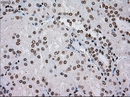 m00913 2 anti tyro3 mouse monoclonal antibody clone id oti5b4 ihc testing 12