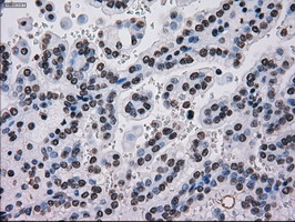 m00913 2 anti tyro3 mouse monoclonal antibody clone id oti5b4 ihc testing 13