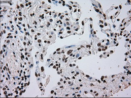 m00913 2 anti tyro3 mouse monoclonal antibody clone id oti5b4 ihc testing 14
