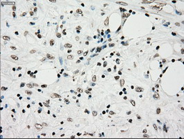 m00913 2 anti tyro3 mouse monoclonal antibody clone id oti5b4 ihc testing 4