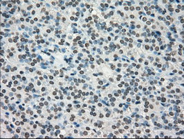 m00913 2 anti tyro3 mouse monoclonal antibody clone id oti5b4 ihc testing 5