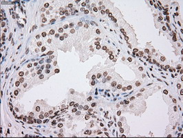m00913 2 anti tyro3 mouse monoclonal antibody clone id oti5b4 ihc testing 7