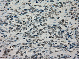 m00913 2 anti tyro3 mouse monoclonal antibody clone id oti5b4 ihc testing 9