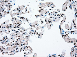 m00913 3 anti tyro3 mouse monoclonal antibody clone id oti2c4 ihc testing 10