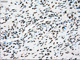 Immunohistochemical staining of paraffin-embedded Human Ovary tissue within the normal limits using anti-TYRO3 mouse monoclonal antibody