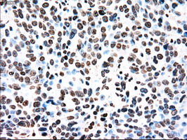 m00913 3 anti tyro3 mouse monoclonal antibody clone id oti2c4 ihc testing 4