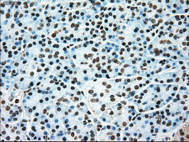 m00913 3 anti tyro3 mouse monoclonal antibody clone id oti2c4 ihc testing 5
