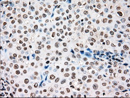 m00913 3 anti tyro3 mouse monoclonal antibody clone id oti2c4 ihc testing 7