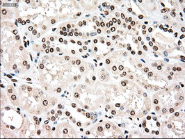 m00913 3 anti tyro3 mouse monoclonal antibody clone id oti2c4 ihc testing 8