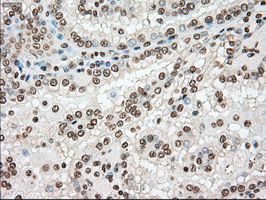 m00913 3 anti tyro3 mouse monoclonal antibody clone id oti2c4 ihc testing 9