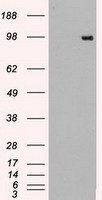 HEK293T cells were transfected with the pCMV6-ENTRY control (Left lane) or pCMV6-ENTRY TYRO3 (Right lane) cDNA for 48 hrs and lysed