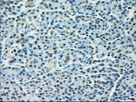 Immunohistochemical staining of paraffin-embedded Human pancreas tissue within the normal limits using anti-TYRO3 mouse monoclonal antibody