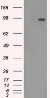 HEK293T cells were transfected with the pCMV6-ENTRY control (Left lane) or pCMV6-ENTRY TYRO3 (Right lane) cDNA for 48 hrs and lysed