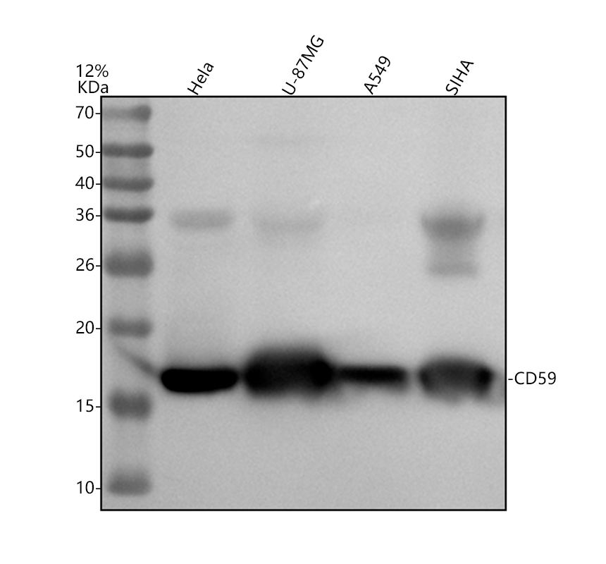 Western blot analysis of CD59 using anti-CD59 antibody (M00914-1)