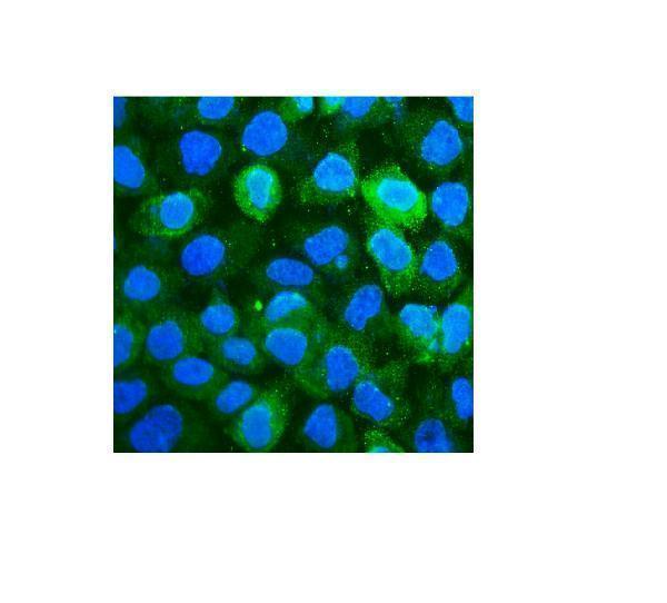  IF analysis of CD59 using anti-CD59 antibody (M00914-2)