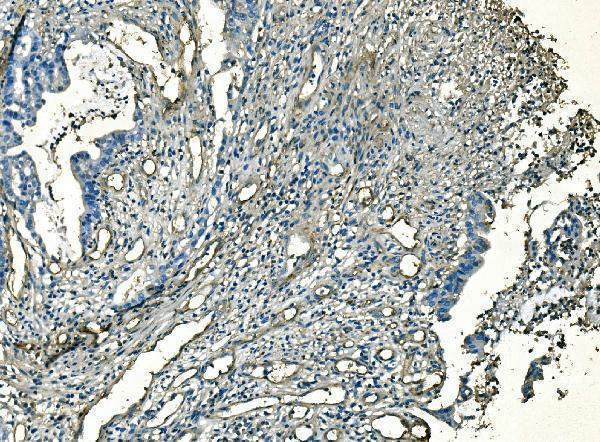 m00914 2 cd59 primary antibodies ihc testing 5