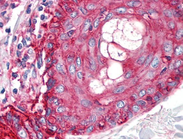 m00914 3 hu cd59 primary antibodies ihc testing 2