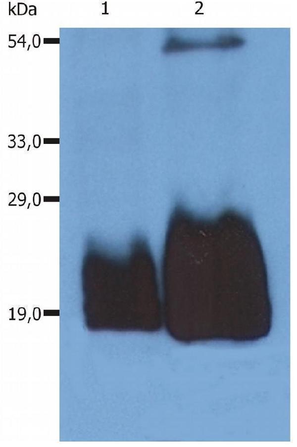 Western blotting analysis (non-reducing conditions) of whole cell lysate of HPB-ALL human peripheral blood T cell leukemia cell line using anti-CD59 (MEM-43/5)