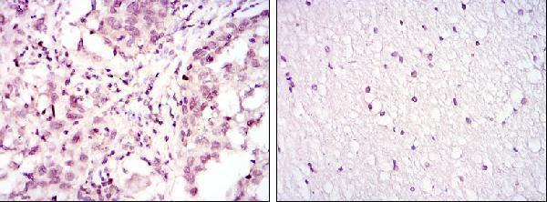 m00916 1 atf2 primary antibodyes ihc testing 2