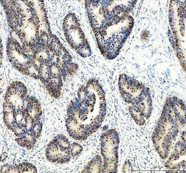 m00916 atf2 primary antibodies ihc testing 2