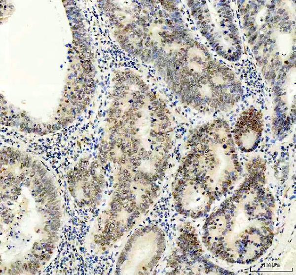 m00916 atf2 primary antibodies ihc testing 3