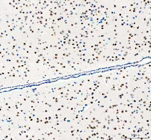 m00916 atf2 primary antibodies ihc testing 4