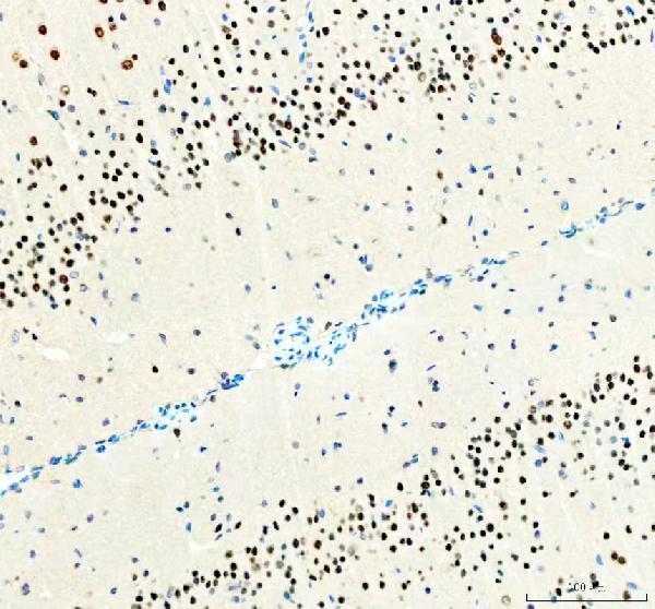 m00916 atf2 primary antibodies ihc testing 5