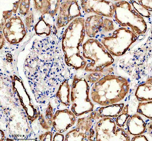 IHC analysis of CPT1A using anti-CPT1A antibody (M00917)