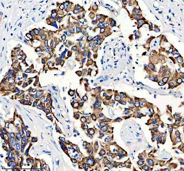 IHC analysis of CPT1A using anti-CPT1A antibody (M00917)