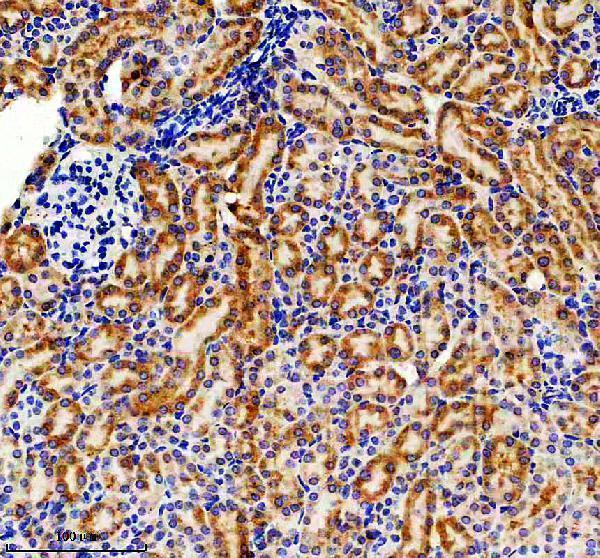 m00917 cpt1a primary antibodies ihc testing 3