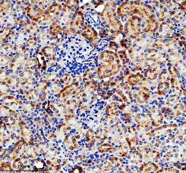 m00917 cpt1a primary antibodies ihc testing 4
