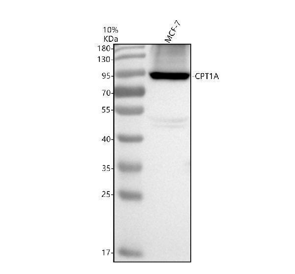 Western blot analysis of CPT1A using anti-CPT1A antibody (M00917)