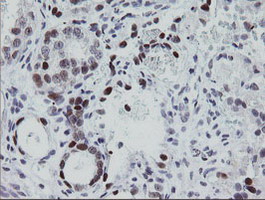 m00921 anti egr2 mouse monoclonal antibody clone id oti1b12 ihc testing 2