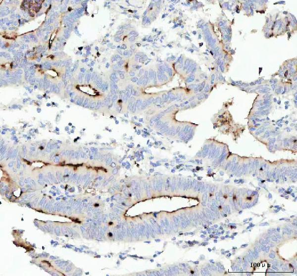 m00923 2 ceacam1 primary antibodies ihc testing 2